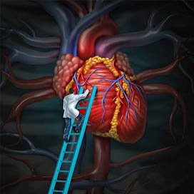 cardiac surgery